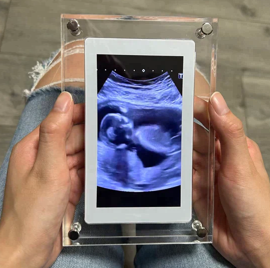 Digital Photo Frame